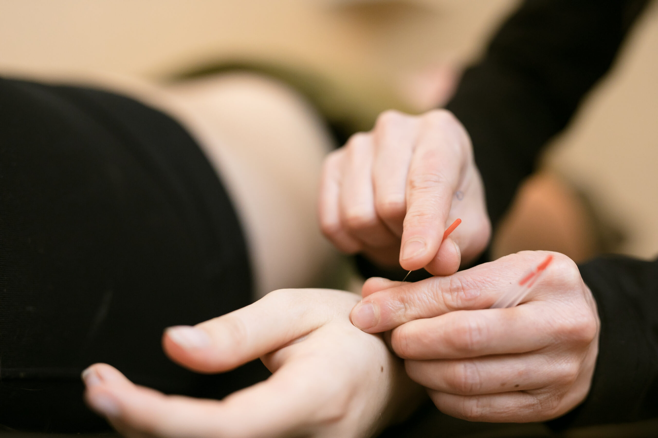 Sang Montage administering acupuncture into a patient.